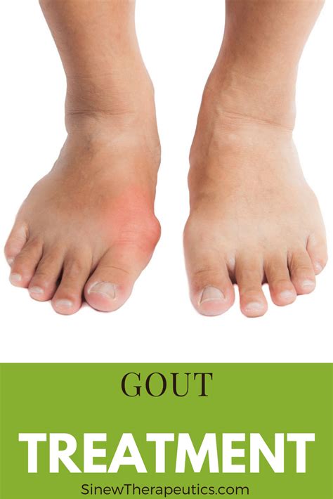 Pin On Gout