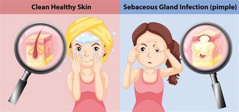 A Comparison Of Skin Condition 368110 Vector Art At Vecteezy
