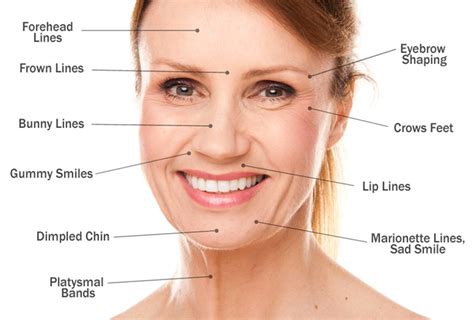 Injectables Botox Kybella And Dermal Fillers Juvederm Fort Worth Eye