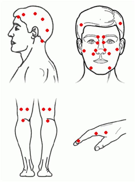 How To Get Relief And Cure From Sinuses With Acupressure Therapy