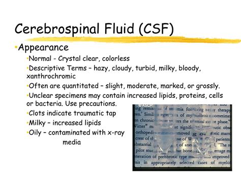 Ppt Urinalysis And Body Fluids Crg Powerpoint Presentation Free Hot Sex Picture