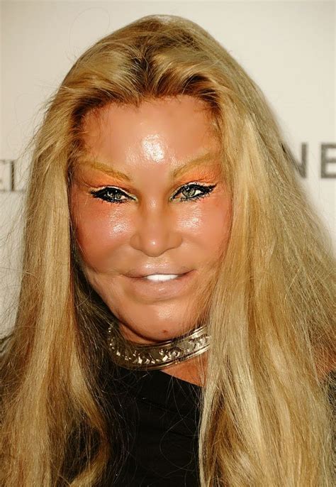 Catwoman Jocelyn Wildensteins Changing Face And Life Story As Shes