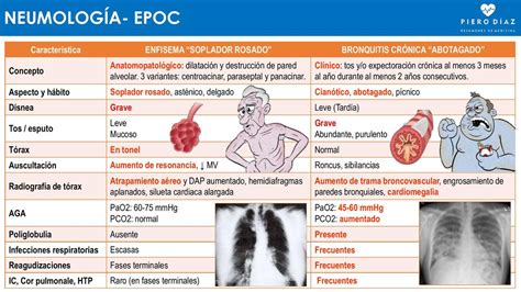 Bronquitis Vs Enfisema Epoc Pierodiaz Med Pierodiaz Med Udocz