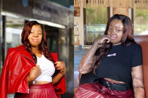 A small nigerian air force passenger plane crashed just outside abuja airport after reporting engine failure on sunday, killing all seven people on board, the air force said. Kechi Okwuchi Marks 15 Years Of Surviving Plane Crash That ...