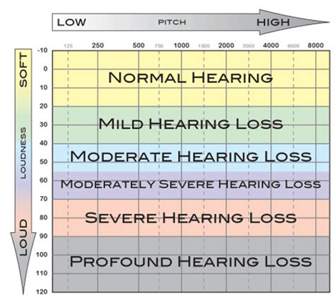 What Degree Of Hearing Loss Means Hearing Doctors Of Nj