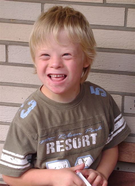 Fileboy With Down Syndrome Wikimedia Commons