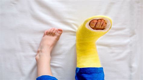 Portland Urgent Care for Broken Bones: Diagnosis & Treatment