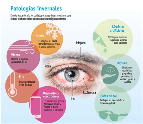 12 consejos para el sindrome del ojo seco infografia infographic images