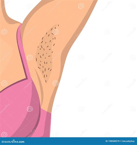 Female Armpit Hair Removal Armpit Red Rash Isolated On White