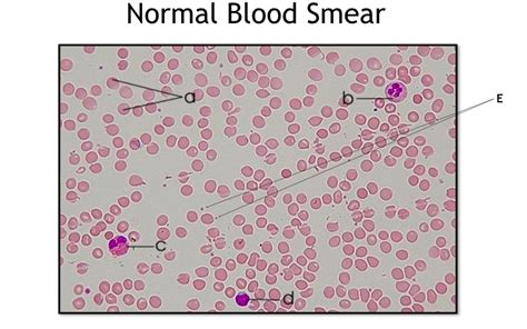 Blood Smear Label Diagram Quizlet
