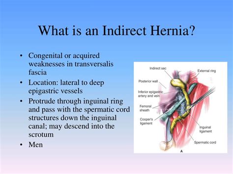 Ppt Traditional Hernia Repair Powerpoint Presentation Free Download