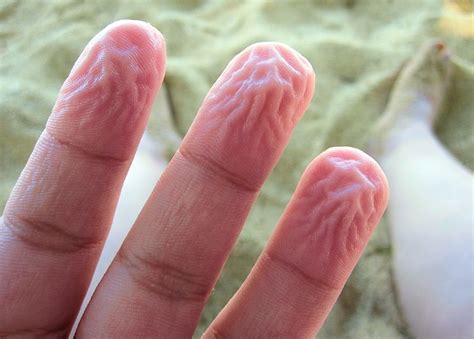 The Mystery Of The Water Wrinkled Fingers
