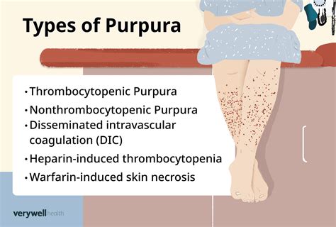 Purpura Bruise Like Spots On Skin That Arent Bruises