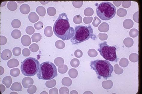 8 Best Images About Monocytes On Pinterest Blood The Ojays And