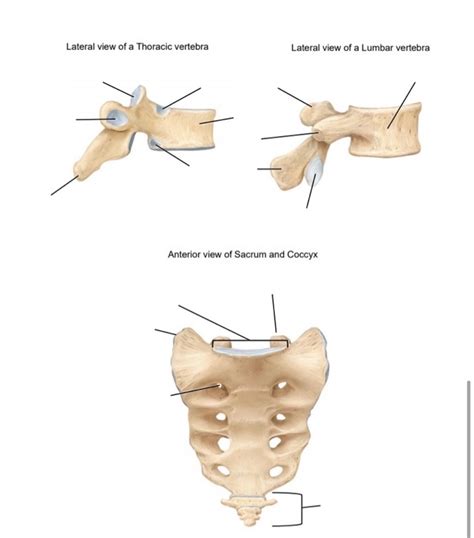 Solved Lateral View Of A Thoracic Vertebra Lateral View Of A Chegg Com