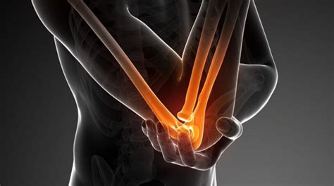 Elbow Arthritis Dr Manuj Wadhwa Best Knee Hip Replacement