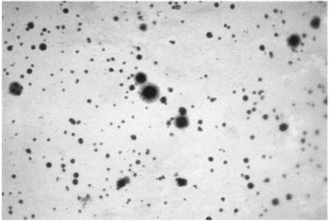 Genital Mycoplasmas Oncohema Key