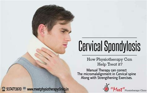 Cervical Spondylosis Causes Symptoms Exercises Treatm Vrogue Co