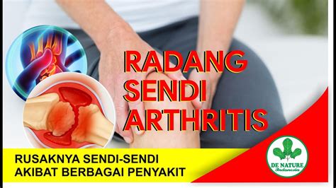 waspadai kebiasaan kebiasaan penyebab radang dan nyeri sendi begini cara pengobatan arthritis