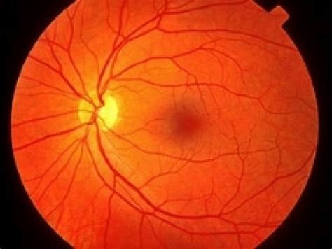 If you are undertaking the immigration medical exam while abroad, you will also need to bring the national visa center letter advising you of. Retinal Imaging