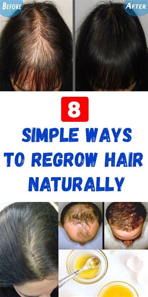 8 Tips To Naturally Regrow Your Hair Faster Regrow Hair Naturally