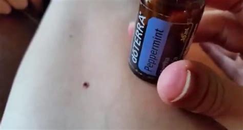 How To Remove Ticks With Peppermint Oil Pepermint Essential Oil Tick