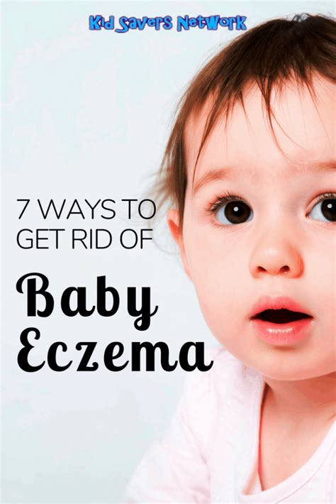 7 Ways To Get Rid Of Baby Eczema