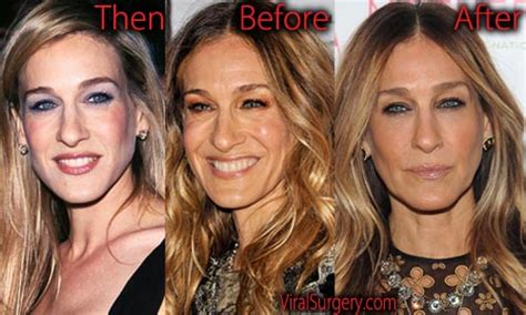Sarah Jessica Parker Plastic Surgery Before And After Boob Job Pictures