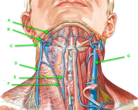 Two leading causes of death, myocardial infarction and stroke each may directly result from an arterial system that has been slowly and progressively compromised by years of deterioration. B02_04 Triangles of the Neck - StudyBlue