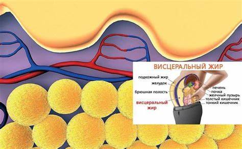 Как убрать висцеральный жир с живота упражнения