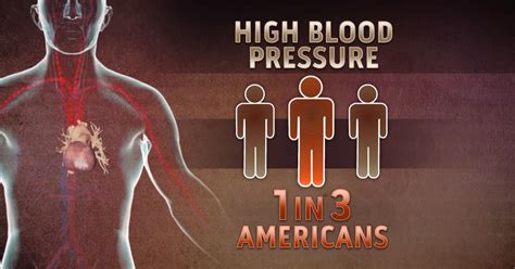 Cardiologists Concerned Over New Blood Pressure Guidelines