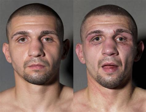 A Boxers Face Before And After Taking A Few Punches 11 Pics