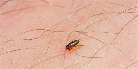 getting rid of human fleas pest phobia