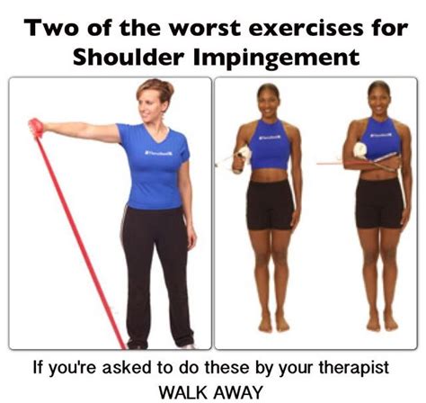 If you're experiencing pain when you exercise, you should temporarily step away from all movements and exercises that pinch your shoulders, yuen says. 17 Best images about Shoulder impingement syndrome on ...