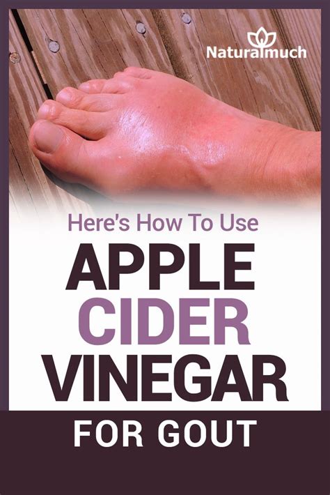 Apple Cider Vinegar For Gout Heres How It Works Home Remedies For