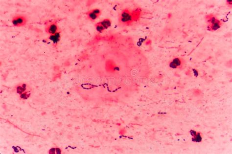 Bacteria Cells Gram Positive Cocci In Chain Stock Photo Image Of