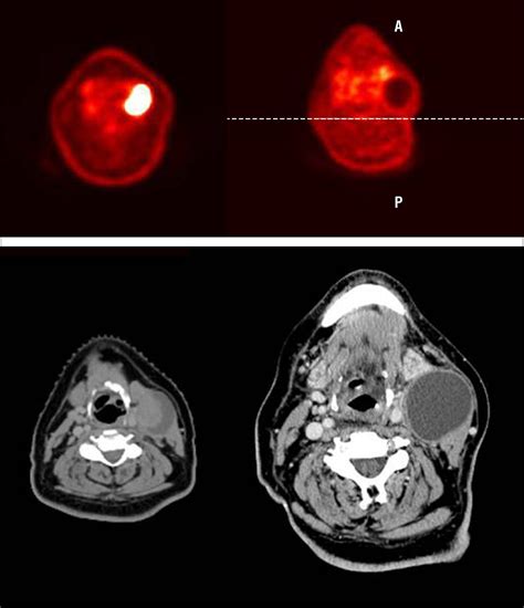 Retrospective Review Of Positron Emission Tomography With Contrast