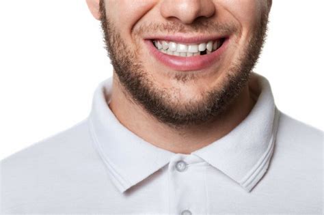 Dentures And Partials Options For Missing Teeth
