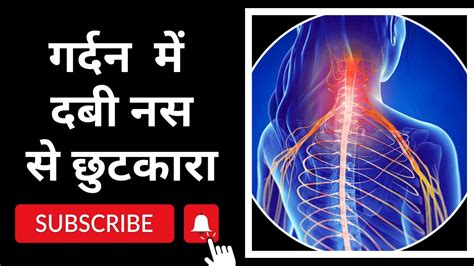 Cervical Radiculopathy In Hindi Cervical Radiculopathy Exercises In