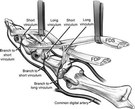 Fdp And Fds Tendons Anatomy Soft Tissue Injuries Of The Hand