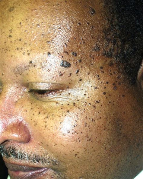 Frecklesage Spots African American Fx Makeup Inspiration Pinter