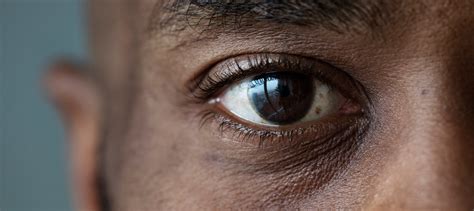 Seeing An Increase In Eye Floaters See Your Eye Doctor Duke Health