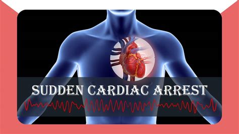 Sudden Cardiac Arrest: 9 Unusual Symptoms You Are About To Have A