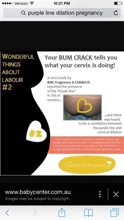 At the end of your pregnancy and eager to meet baby? Purple Line Theory of cervical dilation?? — The Bump