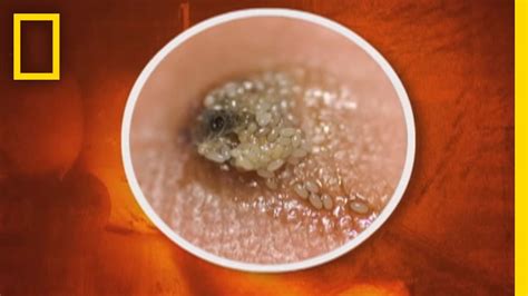 Chiggers are not super dangerous but they can be incredibly annoying and they do bite! How Long Will Chiggers Live On Your Clothes | Sante Blog