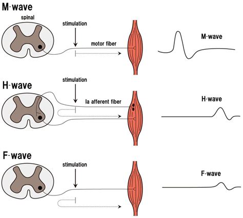 Know Your Spinal Cord The F Wave Lunatic Laboratories