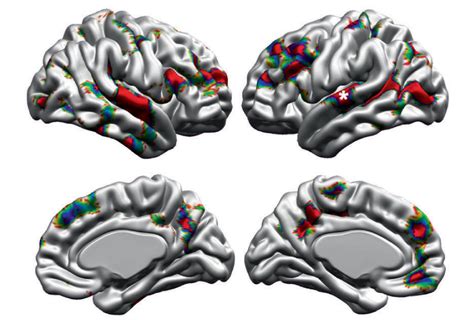 Brain Anatomy Differences In Autism May Vary By Age Sex Spectrum