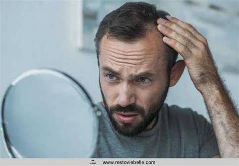 Best Hair Loss Treatments For Men That Work In