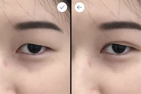 Perhaps this is one of the first questions that app brands and developers ask when they launch an app development project. Why double eyelid surgery is on the rise in Asia: rising ...