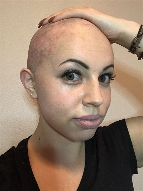 alopecia half shaved shaved head bald look exposure therapy shave her head bald girl